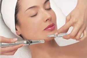 Fraction mesotherapy (microneedling)